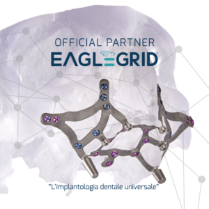 Dentsmile srl, partner ufficiale di Eaglegrid, un protocollo innovativo che consente di inserire gli impianti dentali anche nei casi di atrofia ossea più complessi.